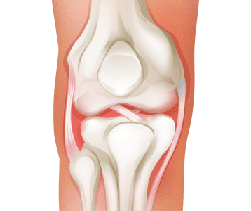 Joints, ligaments, and cartilage